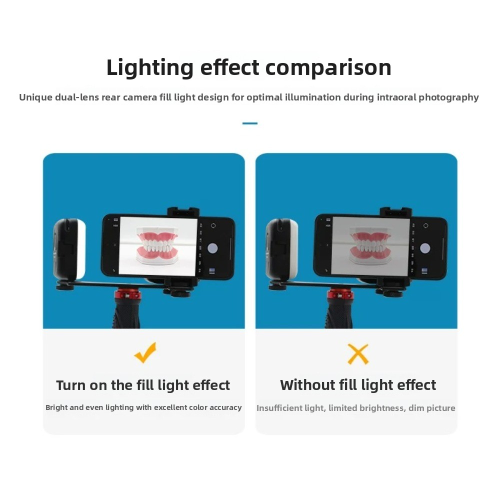 Dental Photography Light, Blue - Photography Lighting Kits review and price